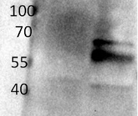 BAM1 | Beta amylase 1 (chloroplastic) in the group Antibodies Plant/Algal / Photosynthesis / Sucrose metabolism at Agrisera AB (Antibodies for research) (AS15 2895)